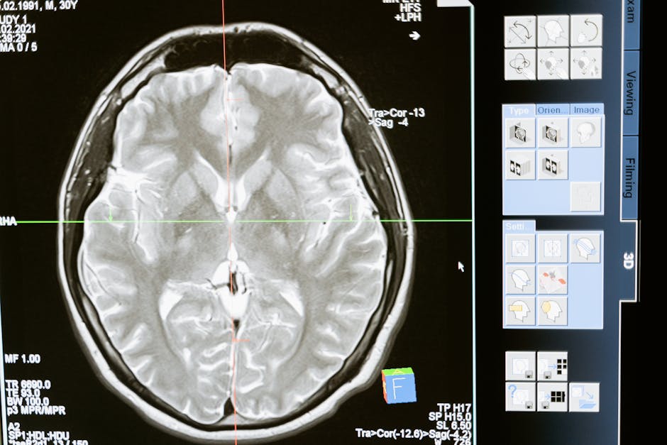 brain computer interface